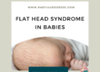 flat head syndrome in babies