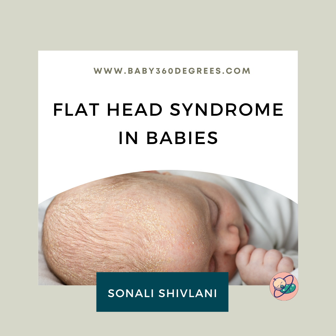 flat head syndrome in babies